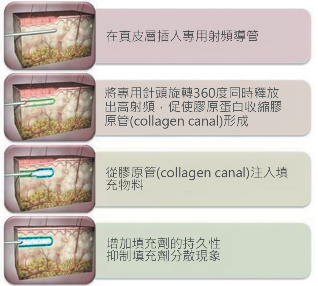 治療方法