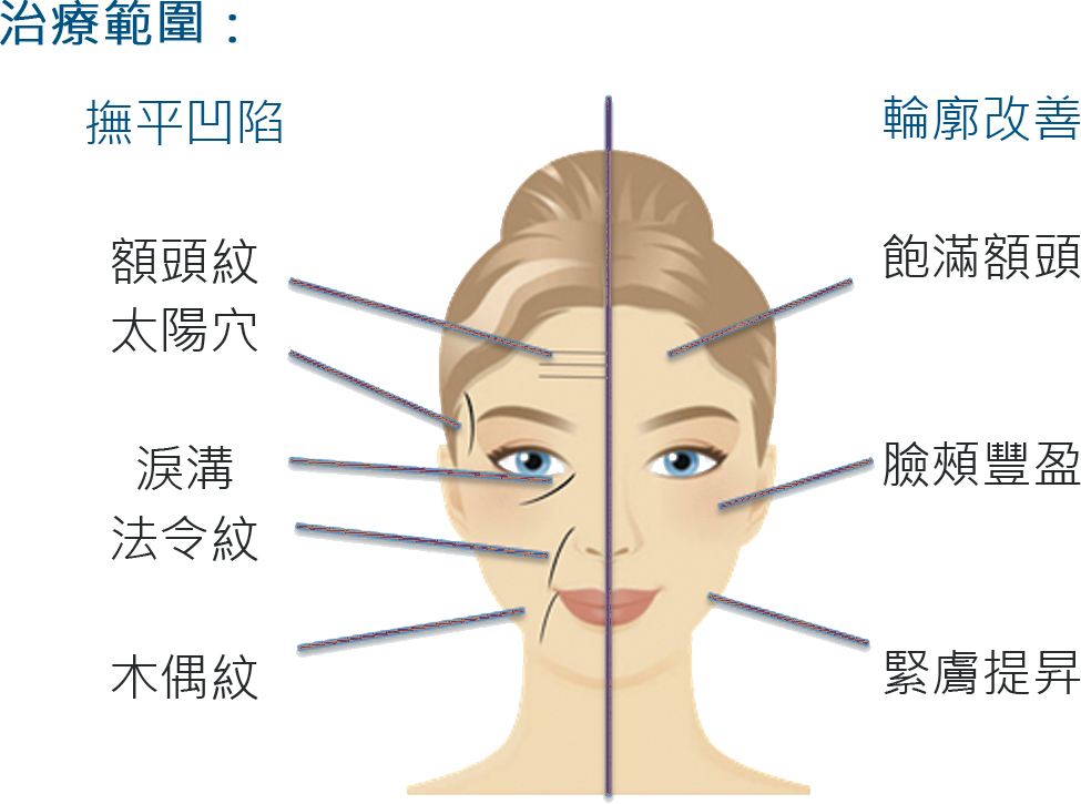 innofill治療範圍