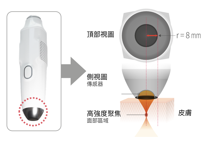 liftera cool冰感無針埋線手柄結構